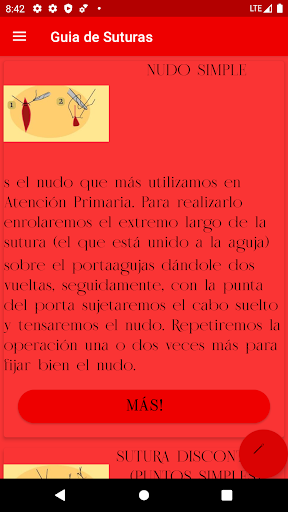 Guia de suturas Screen 3