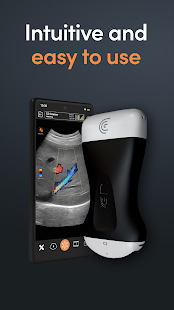 Clarius Ultrasound Screenshot