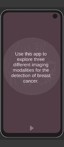 Insight into Breast Imaging Screen 2