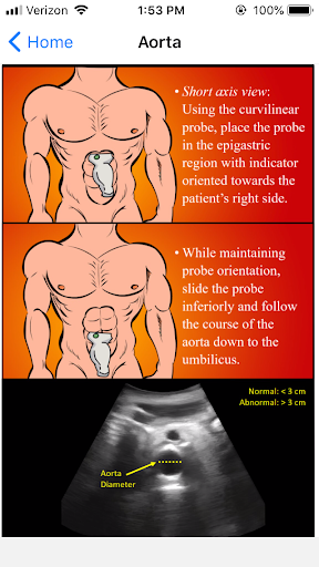 EM Ultrasound Screen 3