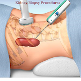 Kidney Biopsy Procedures icon
