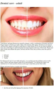 あなたの歯の世話をする方法