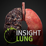 Cover Image of 下载 INSIGHT LUNG  APK