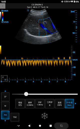 Ultrasound Touch Screen 3
