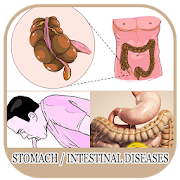 All Stomach Diseases and Treatment