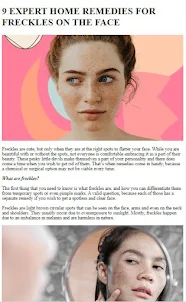 Freckles Home Remedies Tips