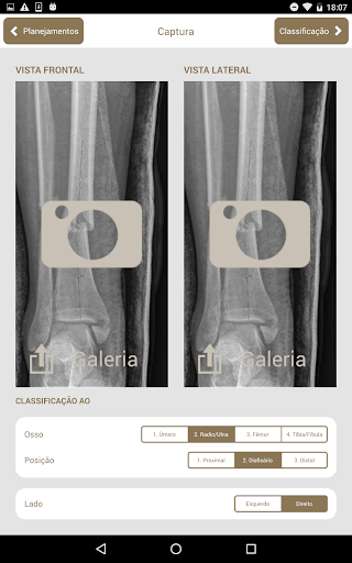 Android application Osteotrauma screenshort