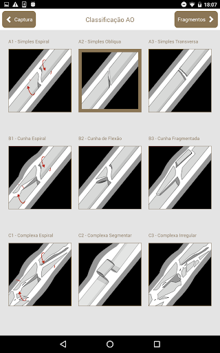 Osteotrauma Screen 2
