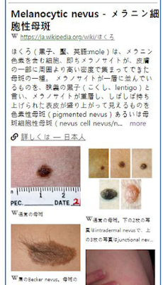 Model Dermatol – 皮膚疾患のおすすめ画像2