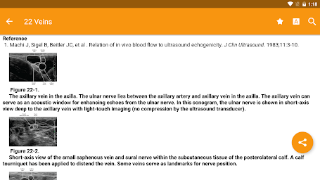 Atlas of Ultrasound Anesthesia