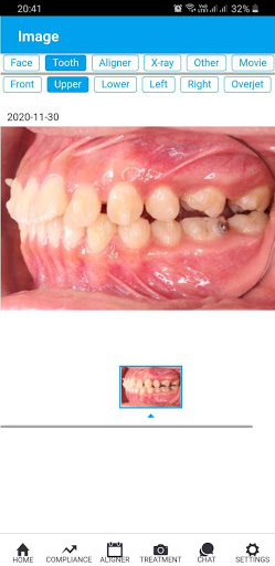 OrthoComm Aligner Management Screen 3