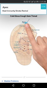 Auricular Acupuncture Microsystems & TCM Diagnosis 5