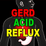 GERD Acid Reflux icon