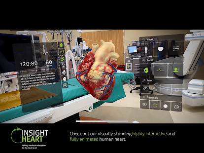 Pamje e ekranit INSIGHT HEART