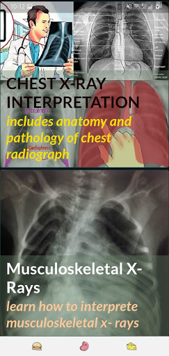X-RAY Interpretation - cases Screenshot