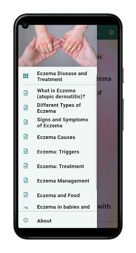 Android application Eczema Disease and Treatment screenshort