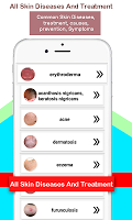 screenshot of Skin Diseases and Treatment