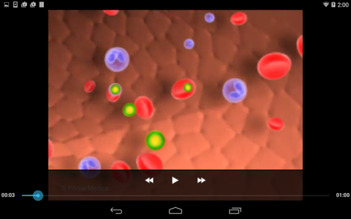 Hypertension - Medical Dict.