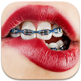 Braces Teeth Booth Pro icon