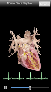Cardiological Screenshot