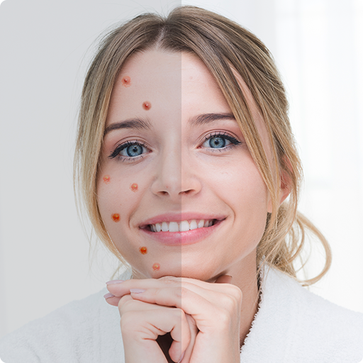 Remove Acne from Face logo