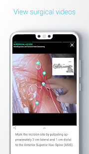 Touch Surgery: Surgical Videos Screenshot
