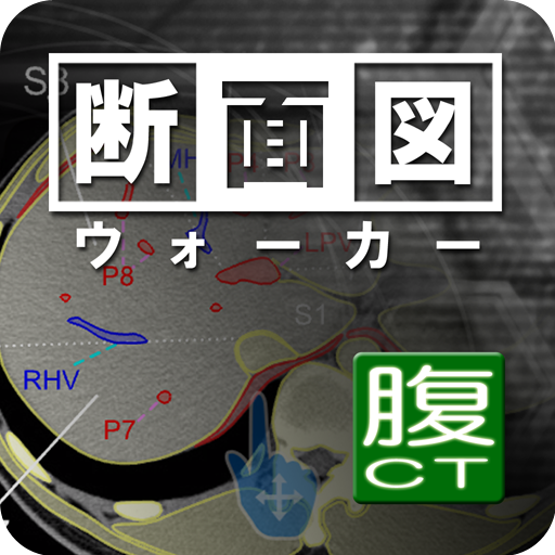 断面図ウォーカー腹部CT