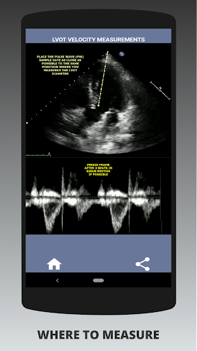 AORTIC STENOSIS PROTOCOL GUIDE Screen 2