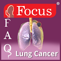 FAQs in Lung Cancer