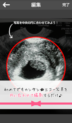 妊娠エコーフレーム エコー写真をかわいいフレームでシェア Androidアプリ Applion