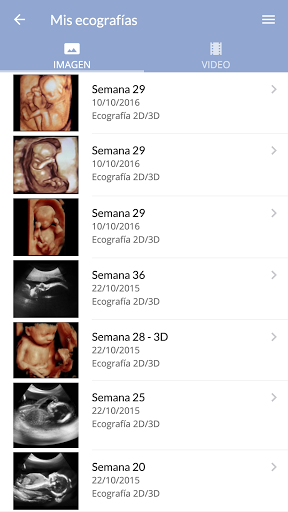 Reproducción Bilbao Screen 3