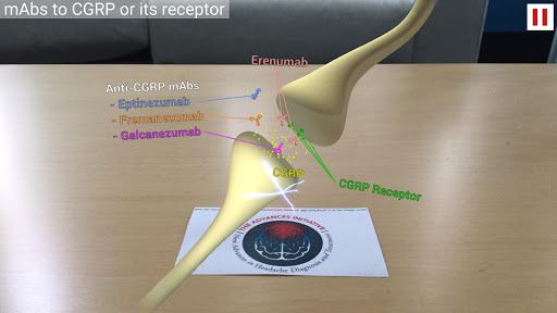 ADVANCES Migraine Augmented Re Screen 2