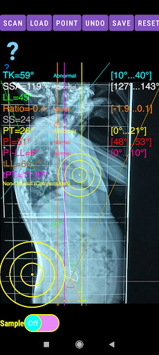 Sagittal Balance App screenshot 15