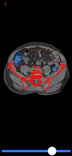 Biopsy Guide Screen 3