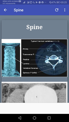 CT Scan Anatomy ATLAS - All in 1