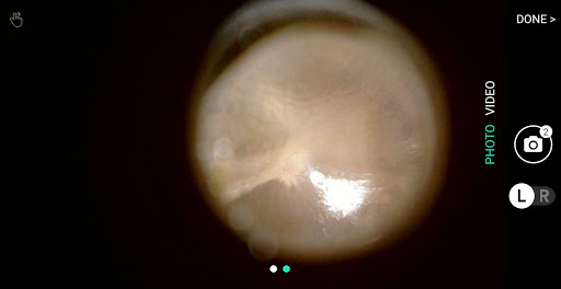 hearScope Screen 2