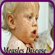 Measles Disease  Icon