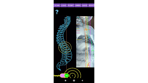 Sagittal Balance App screenshot 23