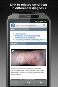 Dermatologie DDx APK (kostenpflichtig/vollständig) 4