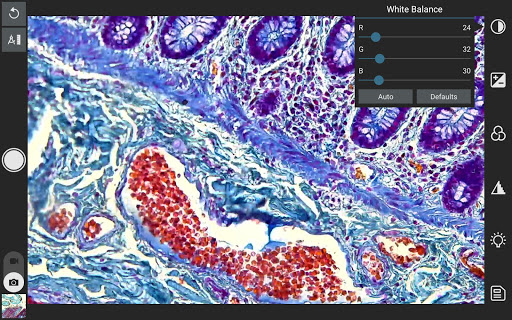 EPview Screen 3