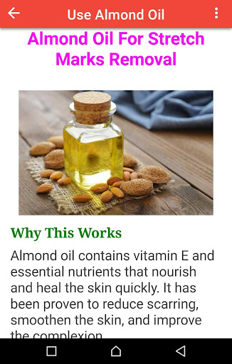 Natural Stretch Marks Removal