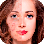 Blemishes Removal: beauty face camera