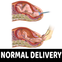 Normal Delivery Tips