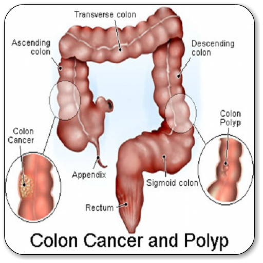 Colon Cancer  Icon