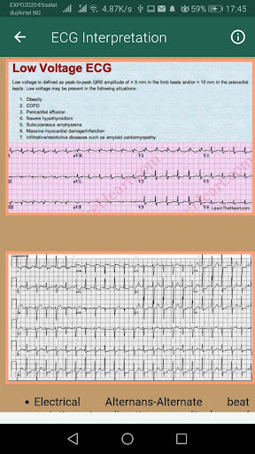 ECG Interpretation Part 1 Screen 2