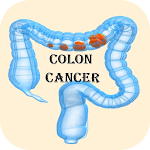 Cover Image of ダウンロード Colon Cancer  APK