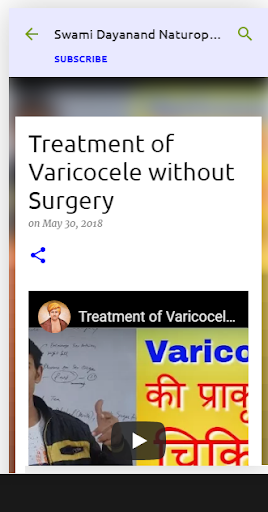 Varicocele Treatment without S Screen 2