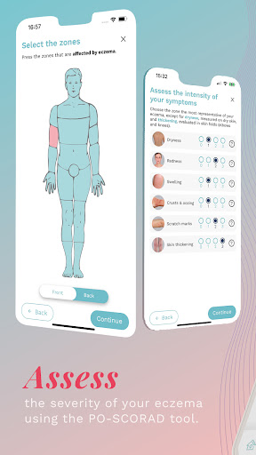 Eczema CARE+ Screen 3
