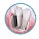 باورهای نادرست درباره ایمپلنت دندان