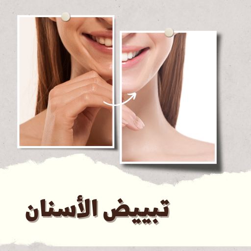 طرق تبييض الأسنان